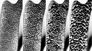 Osteoporosis- پوکی استخوان